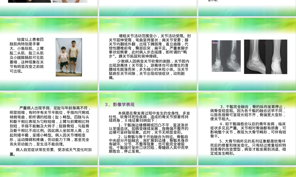 大骨节病基本知识PPT课件.ppt