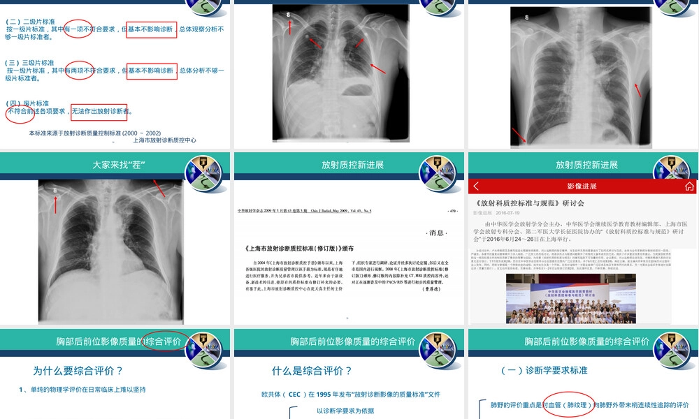 胸部正位摄影与质量控制PPT课件.ppt