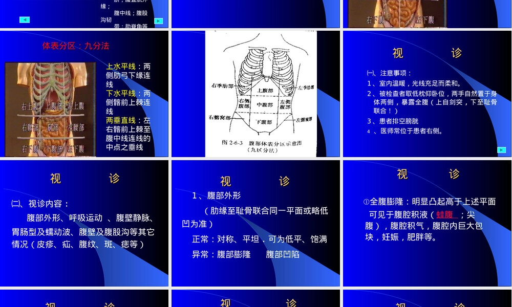 腹部检查教学PPT课件.ppt