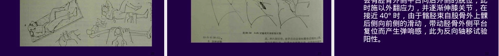 膝关节专科检查PPT课件.ppt