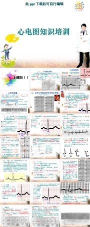 心电图知识培训ppt课件.ppt