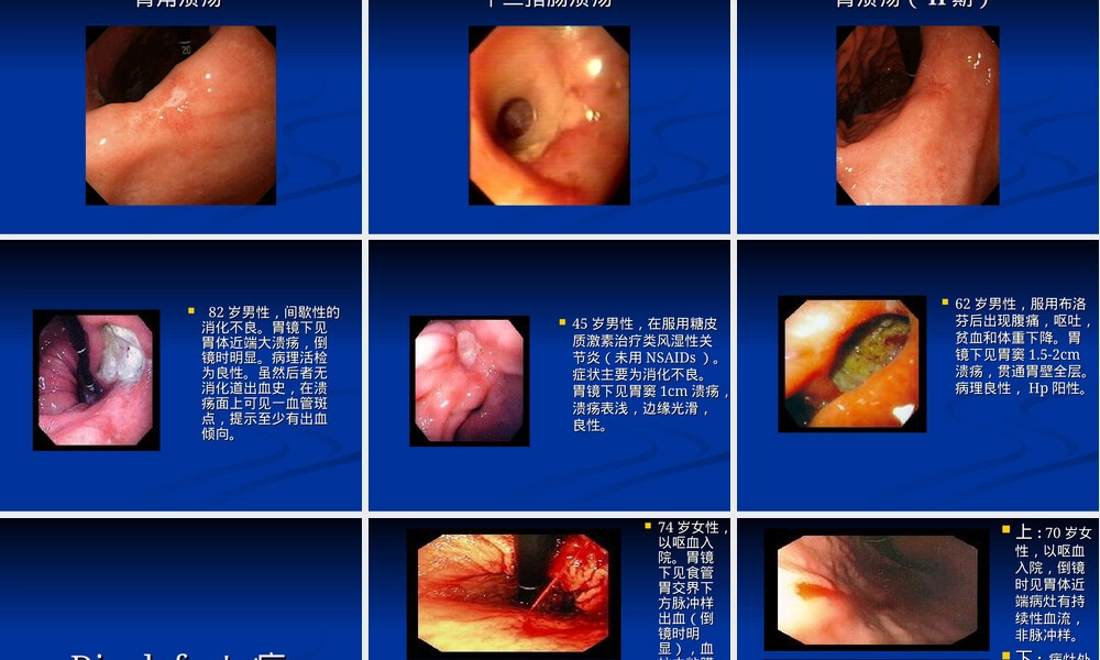 胃镜图谱PPT课件｜正常与常见胃病影像教学.ppt