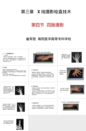 手掌X光摄影标准体位PPT课件.ppt